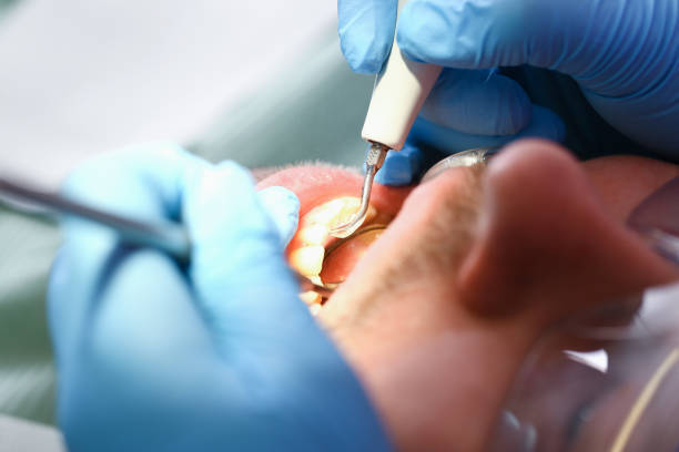 Best Tooth Pain Emergency Relief  in Snyder, OK