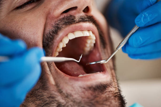 Best Broken Tooth Emergency  in Snyder, OK