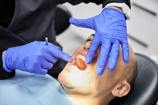 Best Teeth Whitening  in Snyder, OK