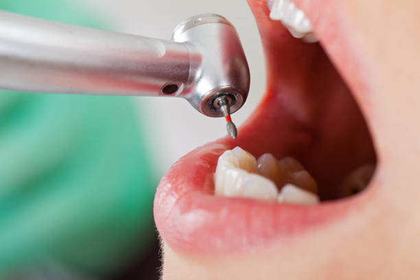 Best Urgent Tooth Repair  in Snyder, OK